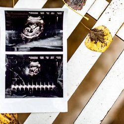 Precious Glance Ultrasound