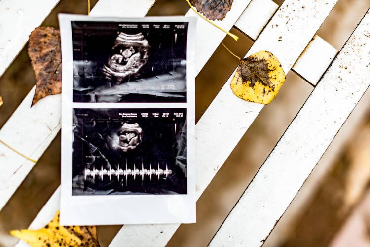 PRECIOUS GLANCE ULTRASOUND Updated August 2024 20 Photos 5225