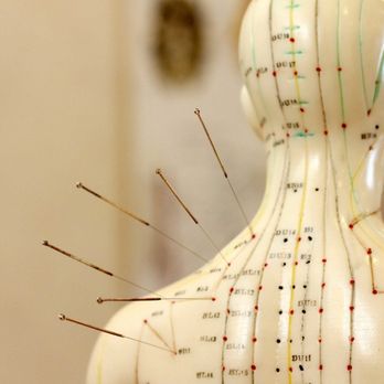 Andre Rafael, Lac - Acupuncture Near Me - Beverly Hills, California Andre Rafael, Lac - Acupuncture Near Me - Beverly Hills, California