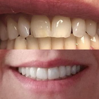 Absolute Dental - Rainbow - I love my new smile!!! Thank you Absolute Dental!!!! - Oral Surgeons Near Me - Las Vegas, Nevada Absolute Dental - Rainbow - I love my new smile!!! Thank you Absolute Dental!!!! - Oral Surgeons Near Me - Las Vegas, Nevada