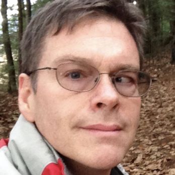 Soares Ocular Surgery - Me, two years ago. - Ophthalmologists Near Me - Randolph, Vermont Soares Ocular Surgery - Me, two years ago. - Ophthalmologists Near Me - Randolph, Vermont