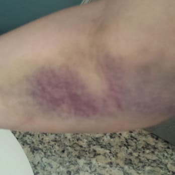 Laureate Medical Group - Don't go to Laureate or this might happen to you! - Medical Centers Near Me - Atlanta, Georgia Laureate Medical Group - Don't go to Laureate or this might happen to you! - Medical Centers Near Me - Atlanta, Georgia
