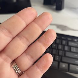 My skin is peeling off from products their using