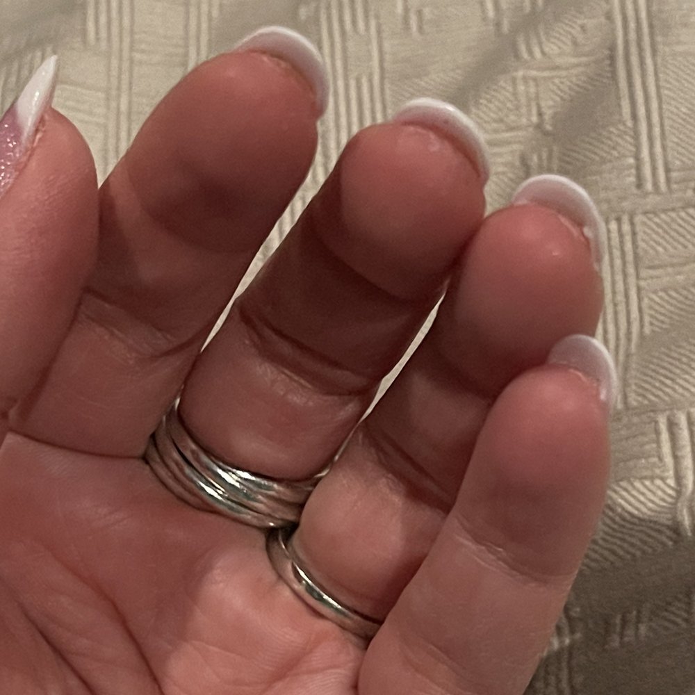 Europe Nails - Powder residue and glue on skin - Nail Salons Near Me - Pittsburgh, Pennsylvania Europe Nails - Powder residue and glue on skin - Nail Salons Near Me - Pittsburgh, Pennsylvania