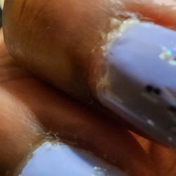 Sky Nail - My cuticles were swollen and actually itched for 2 weeks.