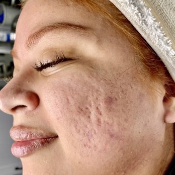 PHD Esthetics - Skin Care Near Me - Tustin, California PHD Esthetics - Skin Care Near Me - Tustin, California