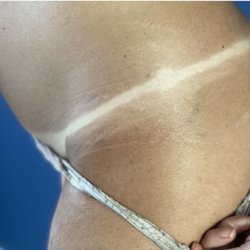 The Bronzed Peach