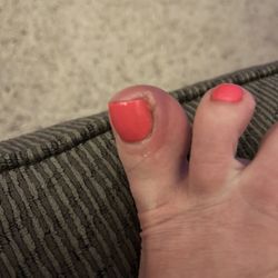 A To Z Nails - After being placed on antibiotics