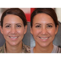 Destin Botox Laser and Facial Esthetics