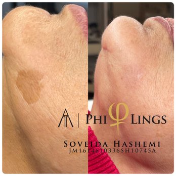 Sovi Cosmetics - Permanent Makeup Near Me - Tarzana , California Sovi Cosmetics - Permanent Makeup Near Me - Tarzana , California