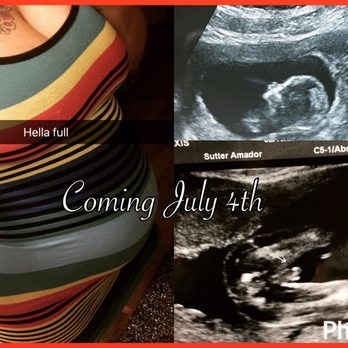 The Baby Connection - My 20 week gender (From Dr) and the 13 week profile from them so much better quality - Diagnostic Imaging Near Me - Roseville, California