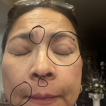 Lake Nails - Technicians also applied solution to my mom's face without her consent, damaged her skin, attempted to charge her for it. - Nail Salons Near Me - Menifee, California Lake Nails - Technicians also applied solution to my mom's face without her consent, damaged her skin, attempted to charge her for it. - Nail Salons Near Me - Menifee, California
