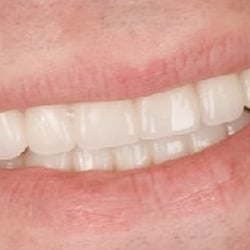 Chris Mohler DDS