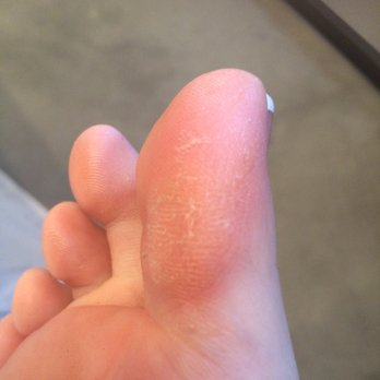 Ben's Nails - So much for the callous scrub - Nail Salons Near Me - Redlands, California Ben's Nails - So much for the callous scrub - Nail Salons Near Me - Redlands, California