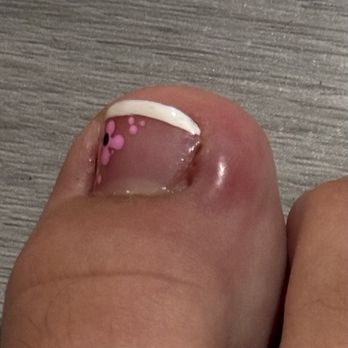 K & K Nail Spa - Infected toe on my daughter ! - Nail Salons Near Me - Moreno Valley, California