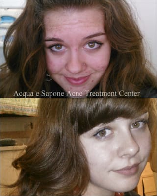 AES Acne Clinic by null
