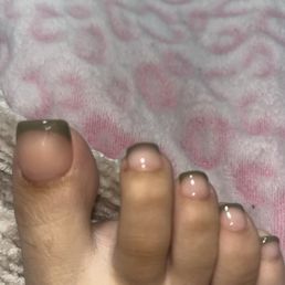 Theres multiple cuts on my cuticles only one drew blood but the rest are peeled.. Theres multiple cuts on my cuticles only one drew blood but the rest are peeled..