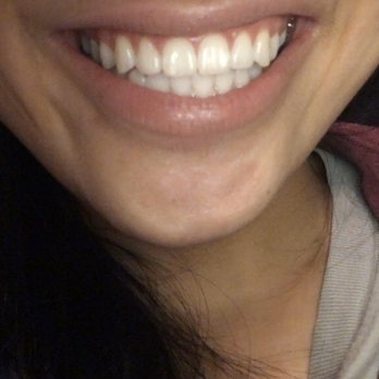Camtu T Nguyen, DDS - General Dentistry Near Me - San Jose, California
