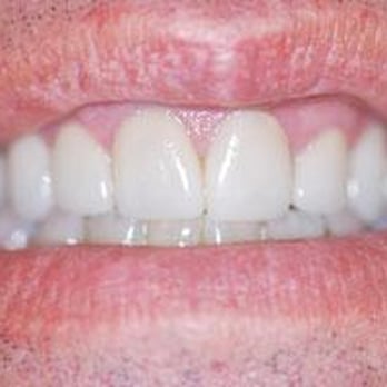 Frank J Salvato Jr, DMD - General Dentistry Near Me - Westfield, New Jersey Frank J Salvato Jr, DMD - General Dentistry Near Me - Westfield, New Jersey