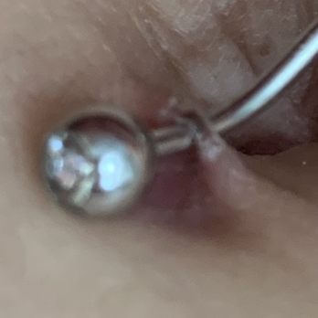 Platinum Ink OC - Right before I had to remove my navel piercing my skin holding it started thinning - Piercing Near Me - Tustin, California