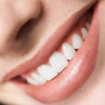 Chicago Smile Design - General Dentistry Near Me - Chicago, Illinois Chicago Smile Design - General Dentistry Near Me - Chicago, Illinois
