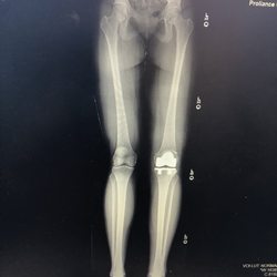 Jonah B. Hulst, MD - Proliance Orthopedic and Sports Medicine