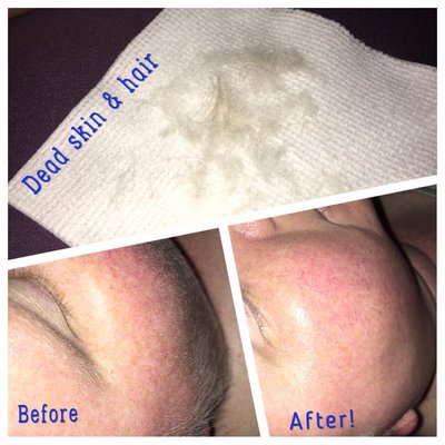 About Face Skin Therapy