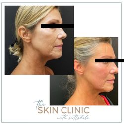 The Skin Clinic - M22 ResurFX
PRX-T33