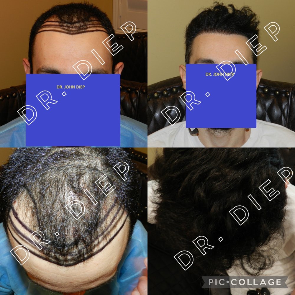 MEDICAL HAIR TRANSPLANT AND AESTHETICS 422 Photos & 80 Reviews