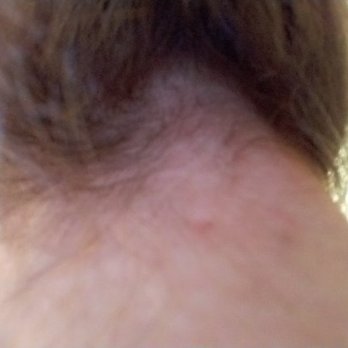 John Casablancas Institute - Burning my neck. - Cosmetology Schools Near Me - Vancouver, British Columbia