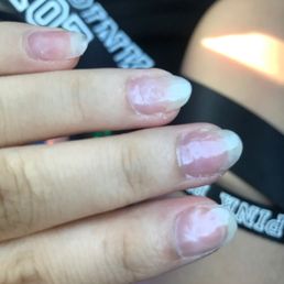 Gel not removed in many places