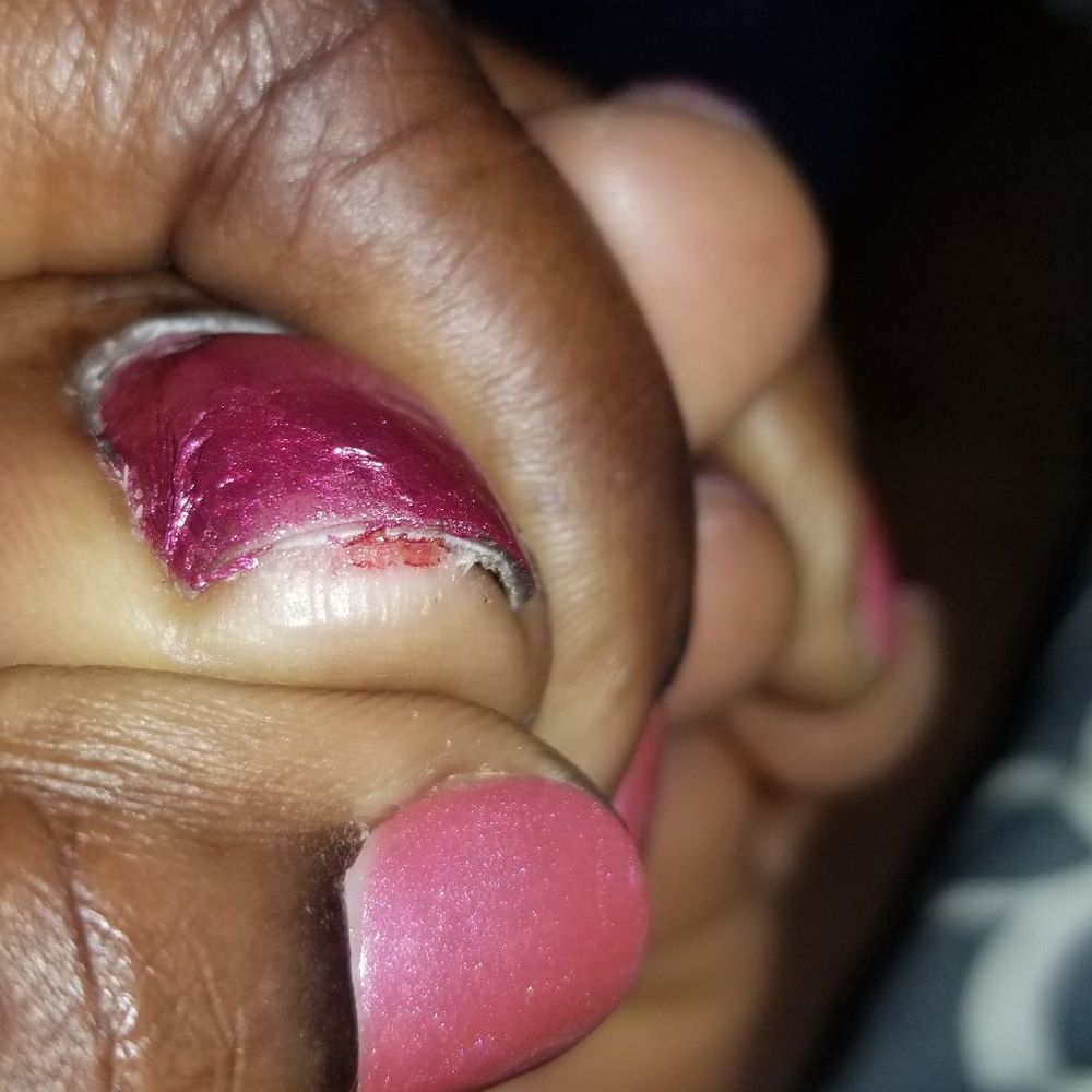 Lucky Nail - My toe she cut to far and the messed up color - Nail Salons Near Me - Bronx, New York Lucky Nail - My toe she cut to far and the messed up color - Nail Salons Near Me - Bronx, New York