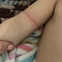 Bright Star Kids Academy - Nonverbal daughter came home hysterical with rubberband around her arm (did not wear her hair in rubber bands that day).