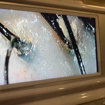 H2O Head Care - Before with all that oil build up - Massage Near Me - San Jose, California H2O Head Care - Before with all that oil build up - Massage Near Me - San Jose, California