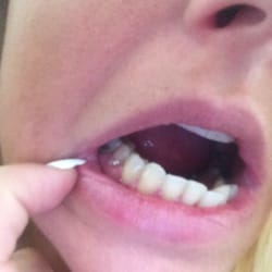 Catherine M. Fascilla, DDS - Before