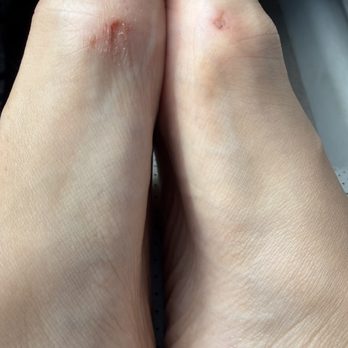 Polish Nails & Wax - next day after him cutting my feet - Nail Salons Near Me - Raleigh, North Carolina Polish Nails & Wax - next day after him cutting my feet - Nail Salons Near Me - Raleigh, North Carolina