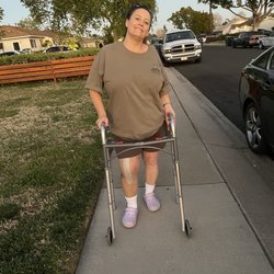 Arrowhead Orthopaedics - Chino Hills - Not even 2 weeks post op