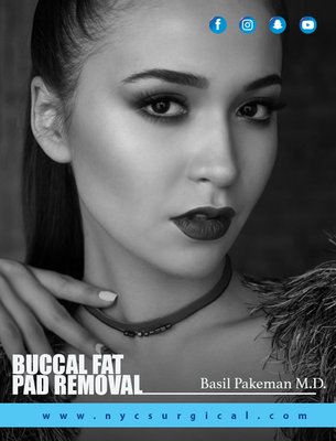 Buccal Fat Removal