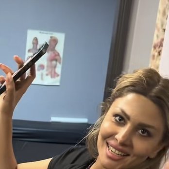 Beauty Me MD - Psycho employee - Medical Spas Near Me - Los Angeles, California