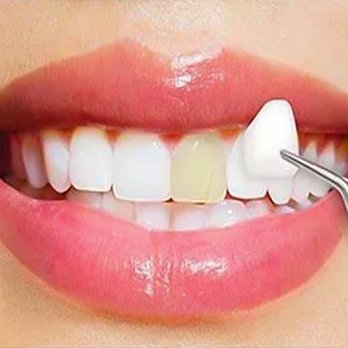 Pauline Lu, DDS - Procelain Veneers - Cosmetic Dentists Near Me - San Jose, California Pauline Lu, DDS - Procelain Veneers - Cosmetic Dentists Near Me - San Jose, California