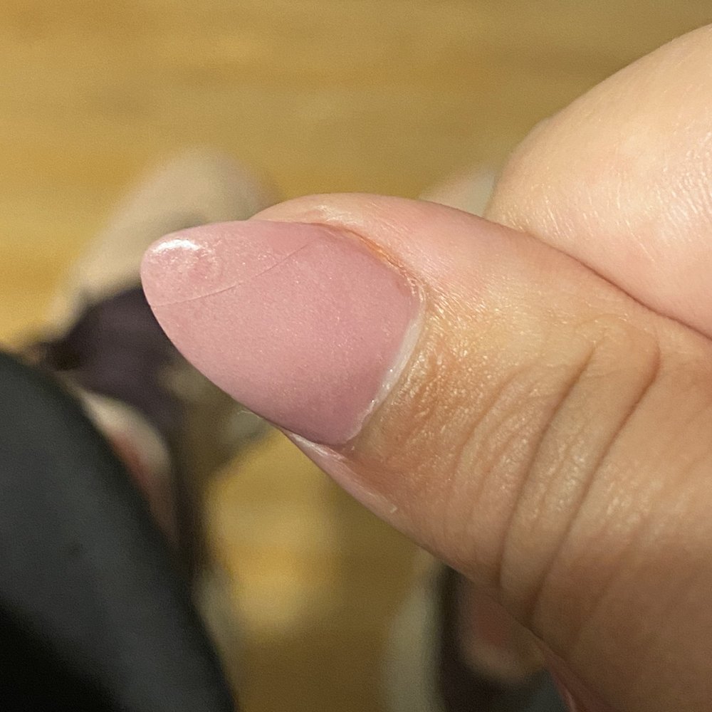 Vida's Nails & Spa - Broken nail. Nails on done Saturday crack by monday. - Nail Salons Near Me - Cumming, Georgia Vida's Nails & Spa - Broken nail. Nails on done Saturday crack by monday. - Nail Salons Near Me - Cumming, Georgia