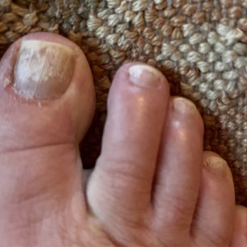 Diamond Nails & Beauty - So this is what your toes will look like two days after their "top" pedicure service - Nail Salons Near Me - Brookfield, Connecticut Diamond Nails & Beauty - So this is what your toes will look like two days after their "top" pedicure service - Nail Salons Near Me - Brookfield, Connecticut