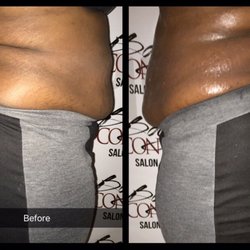 Body Contour Salon and Spa - Before and After Body Contour Slimming Treatment