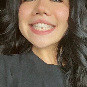 G Smile Care - Before the implant - General Dentistry Near Me - Monrovia, California