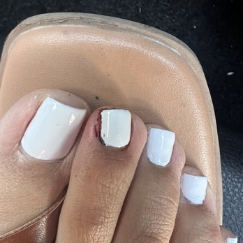 Riches Nail Spa - Bleeding nail - Nail Salons Near Me - Bakersfield, California Riches Nail Spa - Bleeding nail - Nail Salons Near Me - Bakersfield, California