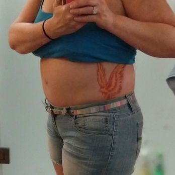 Guy Cappuccino, MD - Does this belly button look at hip level to you?! - Plastic Surgeons Near Me - Mount Airy, Maryland