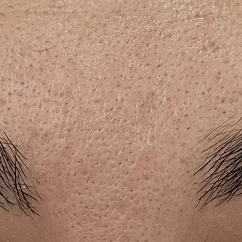 Brow Arc - Montebello - Before and after. Eyebrow, upper lip and neck threading. No tools!!! - Hair Salons Near Me - Montebello, California Brow Arc - Montebello - Before and after. Eyebrow, upper lip and neck threading. No tools!!! - Hair Salons Near Me - Montebello, California