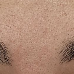 Brow Arc - Montebello - Before and after. Eyebrow, upper lip and neck threading. No tools!!!