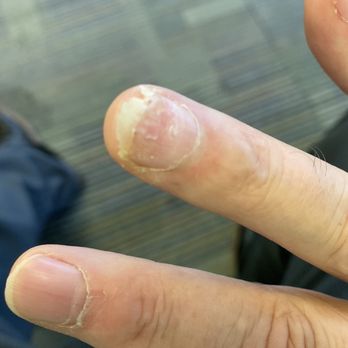 Sammy Nail - Very painful experience - Nail Salons Near Me - Belleville, Illinois