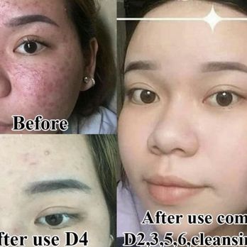 Angelash beauty salon - Thousands of proven benefits and results showing improvement of skin - Eyelash Service Near Me - Vallejo, California Angelash beauty salon - Thousands of proven benefits and results showing improvement of skin - Eyelash Service Near Me - Vallejo, California